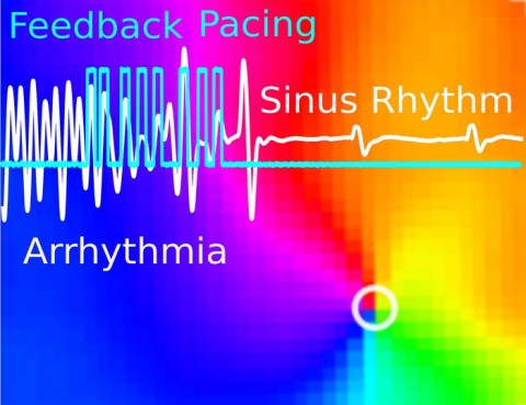 A CARDIAC VENTRICULAR ARRHYTHMIA CAN BE CONVERTED TO A NORMAL SINUS RHYTHM (WHITE LINE) BY USING A SEQUENCE OF LIGHT PULSES (BLUE LINE) IN AN OPTOGENETIC MOUSE HEART. APPLYING SUCH PULSED LIGHT, ROTATING WAVES (MULTICOLOR IN BACKGROUND) DRIVING THE ARRHYTHMIA ARE EFFECTIVELY TERMINATED
